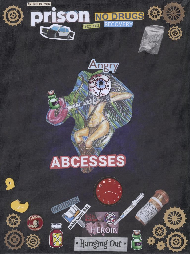 Angry Abscesses
